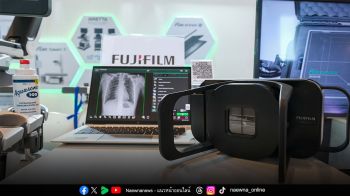 ฟูจิฟิล์มเผยนวัตกรรมวินิจฉัยภาพทางการแพทย์ล่าสุดในงาน AACRT 2025