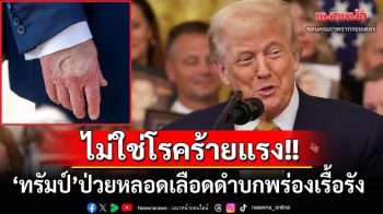 สยบข่าวลือป่วยหนัก! ทำเนียบขาวเผย‘ทรัมป์’มีภาวะหลอดเลือดดำบกพร่องเรื้อรัง ยันไม่ใช่โรคร้ายแรง