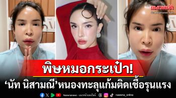 อุทาหรณ์! ยูทูบเบอร์ดัง\'นัท นิสามณี\'แก้มติดเชื้อรุนแรง หลังเคยฉีดสารเหลวกับหมอกระเป๋า