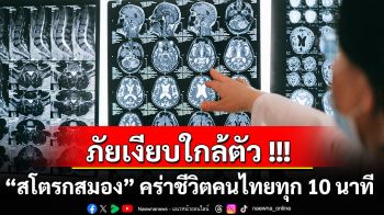 ภัยเงียบใกล้ตัว!!! “สโตรกสมอง” คร่าชีวิตคนไทยทุก 10 นาที  รู้ทัน BEFAST ลดพิการ ลดตาย