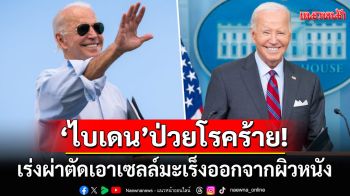 \'โจ ไบเดน\'อดีตปธน.สหรัฐฯ เข้ารับการผ่าตัดเอาเซลล์มะเร็งออกจากผิวหนัง