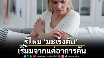 รู้ไหม ‘มะเร็งตับ’ เริ่มมจากแค่อาการคัน