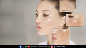 6 ทริค \'ชีวิตติดแดด แต่ผิวไม่ติดฝ้า\' ภัยเงียบจากแสงอาทิตย์ทำร้ายผิว