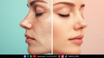 5 Tips & Tricks เพื่อผิวสวยเหนือกาลเวลา รู้ก่อน สร้างผิวที่ดีก่อน