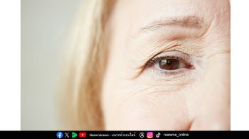 ระวัง แดด ฝุ่น ลม ตัวการ ‘ต้อเนื้อ’ เสี่ยงสายตาเอียงและมองไม่ชัดถาวร