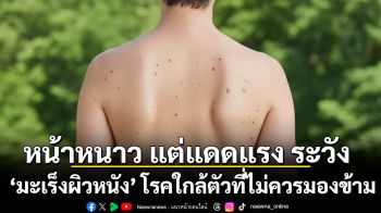 หน้าหนาว แต่แดดแรง ระวัง ‘มะเร็งผิวหนัง’ โรคใกล้ตัวที่ไม่ควรมองข้าม
