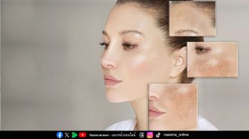 6 ทริค \'ชีวิตติดแดด แต่ผิวไม่ติดฝ้า\' ภัยเงียบจากแสงอาทิตย์ทำร้ายผิว