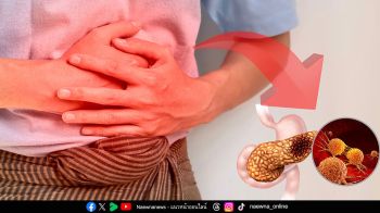 มะเร็งตับอ่อน ภัยเงียบที่คร่าชีวิตสูง เพราะรู้ตัวเมื่อสายเกินไป