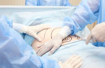 ดูดไขมันที่ไหนดี? เปิดเช็กลิสต์เลือกคลินิกดูดไขมันให้ได้หุ่นสวยและดูเป็นธรรมชาติ