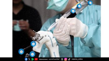 รพ.พระรามเก้า เปิดตัว  ‘PR9’  หุ่นยนต์ผ่าตัดข้อเข่า แม่นยำ เจ็บน้อย ฟื้นตัวเร็ว ทางเลือกใหม่รักษาโรคข้อเข่าเสื่อม