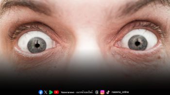 ตาโปน ตาแห้ง ‘ไทรอยด์ขึ้นตา’ โรคอันตรายของเบ้าตาที่ควรรู้