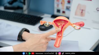 ผู้หญิงปัสสาวะเล็ด อาจไม่ใช่เรื่องเล็ก ภัยเงียบเสี่ยง ‘มดลูกหย่อน’