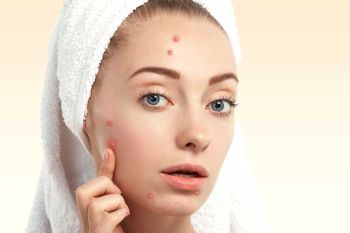 วิธีรักษาสิวอุดตัน ปี 2026 หน้าเรียบเนียน ไม่วนลูปสิวซ้ำ