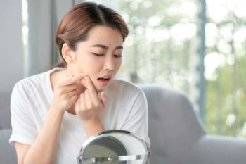 ใครสิวขึ้นบ่อย มานี่เลย! เรารวมทุกวิธีแก้แบบตรงจุดไว้ให้แล้ว