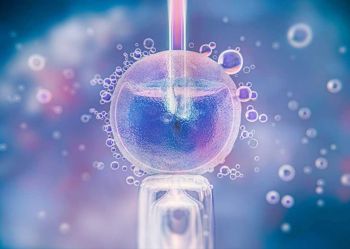 การเตรียมตัวก่อนทำอิ๊กซี่ ต้องทำอะไรบ้าง ?