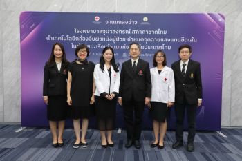 ที่แรกในไทย! รพ.จุฬาลงกรณ์ นำ ‘SGRT’ กำหนดจุดฉายแสงด้วยกล้อง 3 มิติ รักษามะเร็งเต้านมโดยไม่มีเส้นขีดบนผิวหนัง