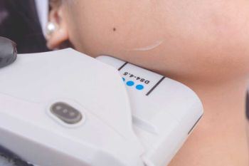 ทำความรู้จัก Hifu เทคโนโลยียกกระชับผิวถึงชั้น SMAS แก้ผิวหย่อนคล้อย ไม่ต้องผ่าตัด