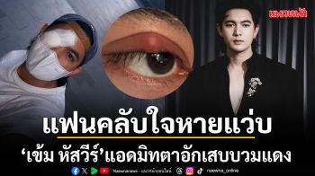 แฟนคลับใจหายแว่บ เข้ม หัสวีร์ แอดมิทด่วน ตาอักเสบบวมแดงจนต้องปิดตา