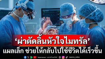 ผ่าตัดลิ้นหัวใจไมทรัล แผลเล็ก ไม่ต้องเปิดอก ช่วยให้กลับไปใช้ชีวิตได้เร็วขึ้น