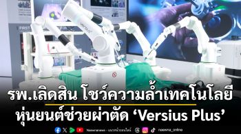‘Versius Plus’ หุ่นยนต์ช่วยผ่าตัดรุ่นใหม่ล่าสุดจากอังกฤษ ‘เลิดสิน’ ปั้น LiROS สู่ศูนย์กลางการเรียนรู้ด้านการผ่าตัดด้วยหุ่นยนต์