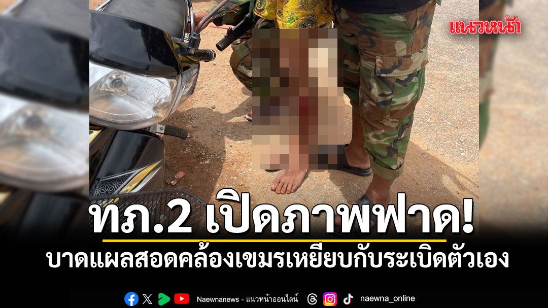 ทภ.2 ยันเหตุบึ้มเกิดในพื้นที่ควบคุมฝ่ายกัมพูชา คาดบาดแผลสอดคล้องเขมรเหยียบกับระเบิดตัวเอง