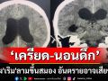 \'หมอ\'เตือน! \'เครียด-นอนดึก-ภูมิต้านทานต่ำ\' เสี่ยง\'เริม\'ลามขึ้นสมอง อันตรายอาจเสียชีวิต