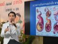 ‘อภัยภูเบศร’ยกผลวิจัย‘มะระขี้นก’พระเอกเบาหวาน ลดน้ำตาล เสริมอินซูลิน
