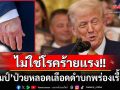 สยบข่าวลือป่วยหนัก! ทำเนียบขาวเผย‘ทรัมป์’มีภาวะหลอดเลือดดำบกพร่องเรื้อรัง ยันไม่ใช่โรคร้ายแรง