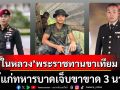 \'ในหลวง\'พระราชทานขาเทียมที่ดีที่สุด ให้แก่ทหารบาดเจ็บขาขาด 3 นาย หลังสู้รบชายแดนไทย-กัมพูชา
