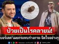 นักร้องดัง\'จัสติน ทิมเบอร์เลค\'ป่วยเป็นโรคลายม์ พบติดเชื้อแบคทีเรียจากการโดนเห็บกัด