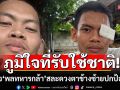 เรื่องเล่าจากชายแดน! \'พลทหารกล้า\'สละดวงตาข้างซ้าย ปกป้องชาติ ภูมิใจที่รับใช้ชาติ
