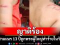 ญาติร้องขอความเป็นธรรม สามเณร 13 ปีถูกพระผู้ใหญ่ใช้ความรุนแรงทำร้ายในวัด
