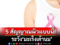 เช็กเลย!!! 5 สัญญาณผิวแบบนี้ ระวัง \'มะเร็งเต้านม\'