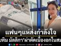 แห่ส่งกำลังใจ! \'ทับทิม มัลลิกา\'ผ่าตัดเนื้องอกในสมอง เผยอาการล่าสุดเซนซิทีฟเรื่องการมองเห็น