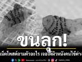 ขนลุก! ชาวเน็ตโพสต์ถามนี่ตัวอะไร เจอใต้ผิวหนังคนไข้ชาวต่างชาติ