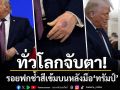 โลกจับตา! รอยฟกช้ำสีเข้มบนหลังมือ ทรัมป์ จุดประเด็นป่วยหนักแต่ปิดบัง