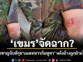 เขมร จัดฉาก? ผู้เชี่ยวชาญจับพิรุธแผลทหารกัมพูชา หลังอ้างถูกฝ่ายไทยยิง