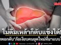 ไม่ดื่มเหล้าก็ตับแข็งได้! ไขมันพอกตับ ภัยเงียบคนยุคใหม่ที่มาแบบไม่รู้ตัว