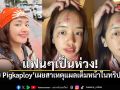 แฟนๆเป็นห่วง! พลอย Pigkaploy เผยสาเหตุแผลเต็มหน้าในทริปสุดขั้วโลก