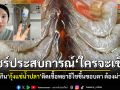 อุทาหรณ์สายดิบ สาวแชร์ประสบการณ์ กินกุ้งแช่น้ำปลา พยาธิไชลามถึงขอบตาจนต้องผ่าตัด