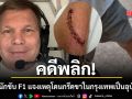 คดีพลิก! อดีตนักขับ F1 แจงเหตุโดนกรีดขาในกรุงเทพเป็นอุบัติเหตุ งงทำไมตร.ไทยมาหาเยอะ