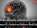 รักษาเหมือนกัน แต่ผลลัพธ์ต่างกัน? หมอสมอง ชี้ 2 ปัจจัยทำคนไข้สโตรก ฟื้นตัวไม่เท่ากัน