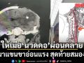 แพทย์ยกเคส ชายวัย 54 ให้เมียนวดคอ ตื่นมาแขนขาอ่อนแรง สุดท้ายสมองตาย (คลิป)
