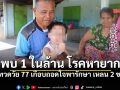 เปิดใจปู่ทวดวัย 77 เกือบถอดใจพารักษา เหลน 2 ขวบป่วยมะเร็งเส้นประสาท พบ 1 ในล้าน