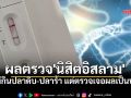 อึ้งอีกเคส! นิสิตอิสลามไม่กินหมู-ปลาร้า-ปลาดิบ แต่ผลตรวจเป็นบวก ติดพยาธิใบไม้ตับ