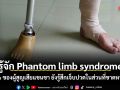 รู้จัก Phantom limb syndrome 90% ของผู้สูญเสียแขนขา ยังรู้สึกเจ็บปวดในส่วนที่ขาดหายไป