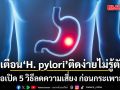 หมอเจด เตือน H. pylori  ติดง่ายแบบไม่รู้ตัว  เปิด 5 วิธีลดความเสี่ยง ก่อนกระเพาะพัง