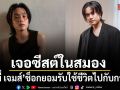 เจมมี่เจมส์ ช็อก เจอซีสต์ในสมอง ยอมรับใช้ชีวิต 30% ไปกับการดื่ม