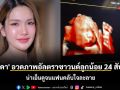 \'ฟารีดา\' อวดภาพอัลตราซาวนด์ลูกน้อย 24 สัปดาห์ น่าเอ็นดูจนแฟนคลับใจละลาย