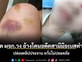 อดีต ผจก.วง อ้างโดนอดีตสามีมือเบสทำร้าย-ปล่อยคลิปประจาน หวั่นไม่ปลอดภัย